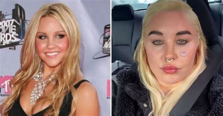
Did Shaughna Phillips Gain Weight? LOve Island Star Ditches Lip Fillers And Looks Different 