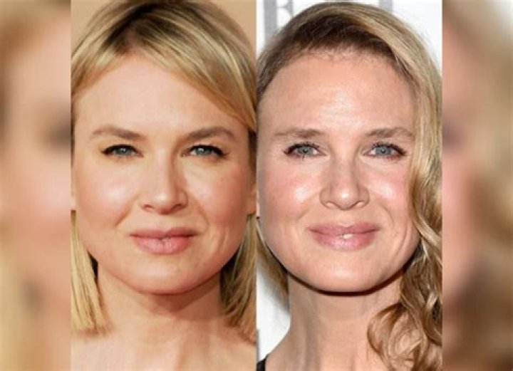 Whatever Happened To Renee Zellweger Following Weight Gain And Plastic Surgery Rumors? Details To Know